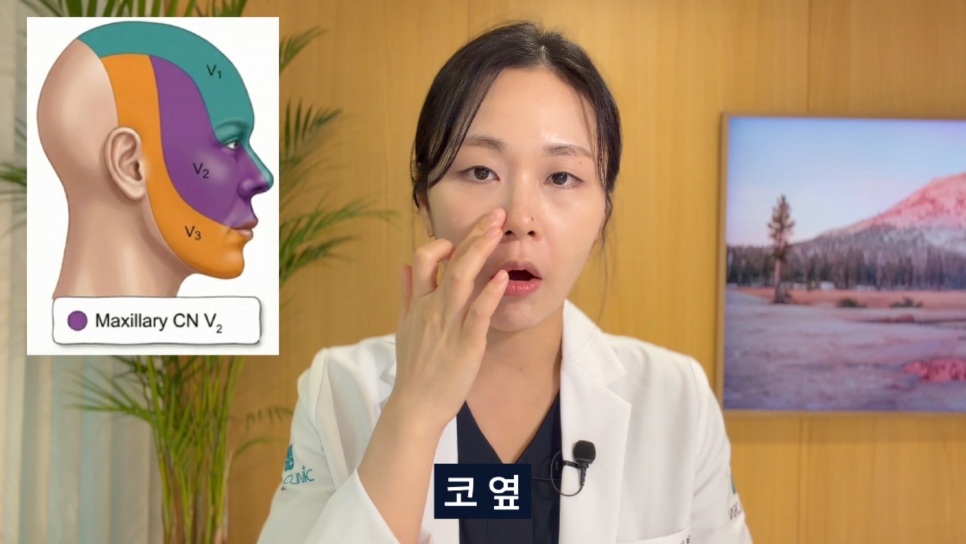 얼굴의 삼차신경 분포를 나타내는 그림과 코 옆을 가리키는 여성의 모습