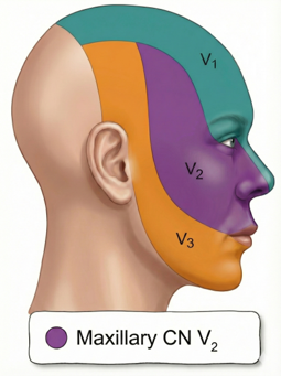 사람 얼굴 측면에 삼차신경의 세 가지 분지(V1, V2, V3) 분포 영역을 색깔로 표시한 그림