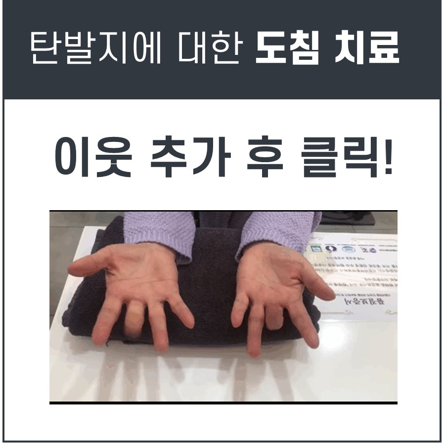 두 손바닥을 위로 향하게 하여 손가락을 구부린 모습으로, 왼쪽 손의 한 손가락이 완전히 펴지지 않은 상태를 보여준다.