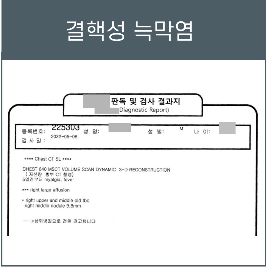 결핵성 늑막염 진단이 적힌 흉부 CT 판독 결과지