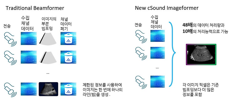 전통적인 빔포머와 새로운 cSound 이미지포머의 초음파 영상 처리 방식을 비교하는 그림 — 초음파 정밀 진단 | 서울 바로한의원 초음파 약침·도침·침도