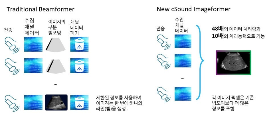 전통적인 빔포머와 새로운 cSound 이미지포머의 초음파 영상 처리 과정을 비교하는 그림 — 초음파 정밀 진단 | 서울 바로한의원 초음파 약침·도침·침도