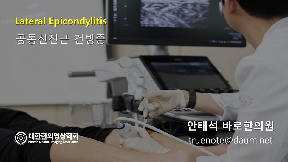 의사가 환자의 팔에 초음파 탐촉자를 대고 초음파 화면을 보며 주사기로 약침 시술을 준비하는 모습.