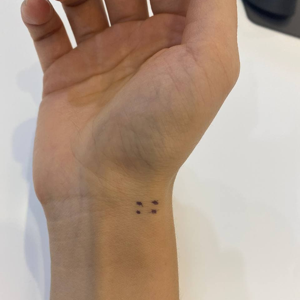 손목에 보라색 점 네 개가 표시된 모습