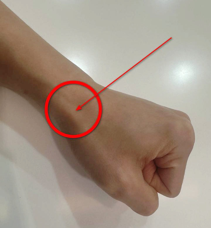 엄지손가락 쪽 손목 부위를 빨간 원과 화살표로 표시한 사진