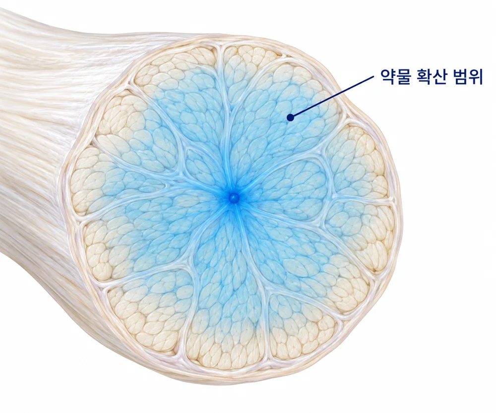 힘줄 단면에 약물이 고르게 퍼지는 범위를 보여주는 모식도
