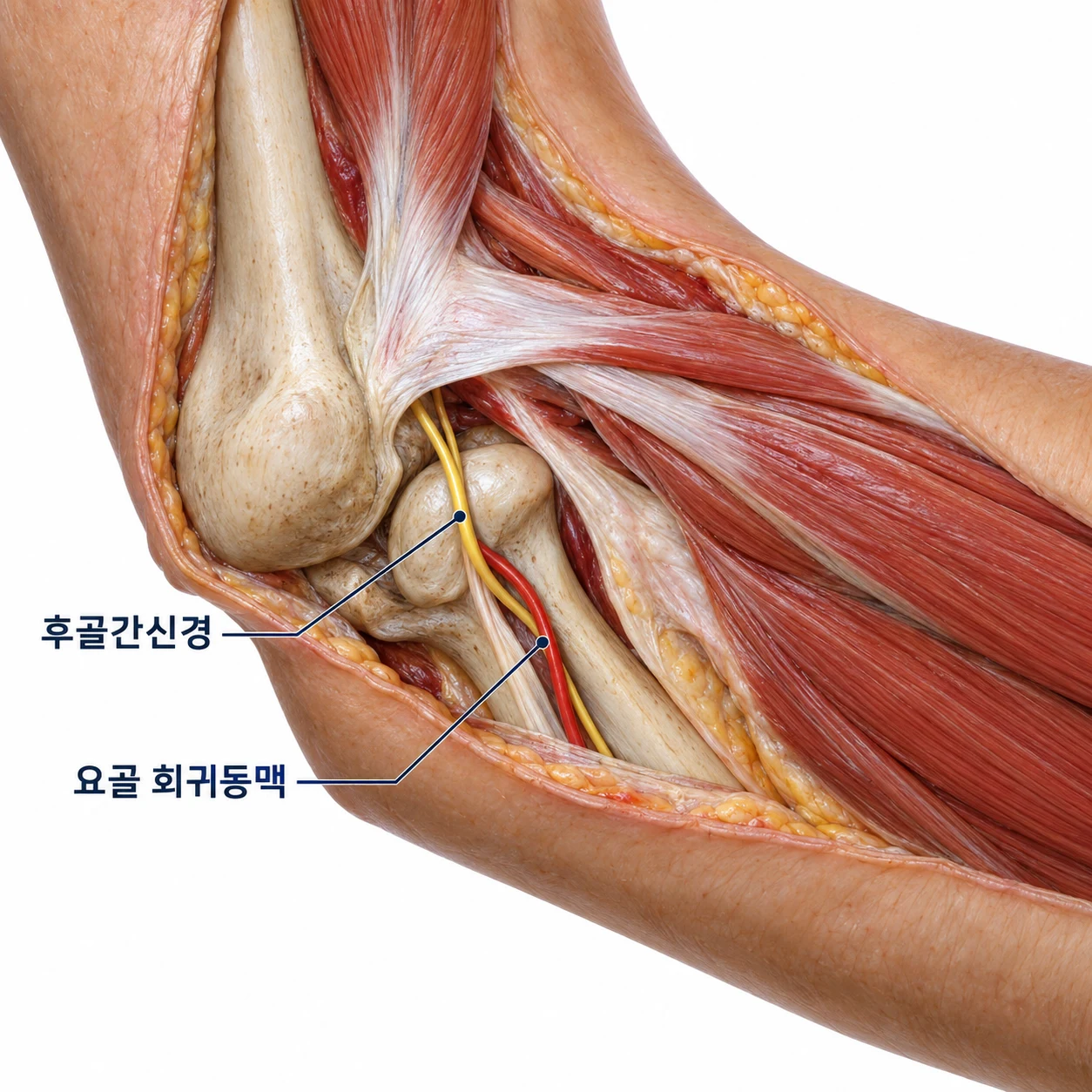 곡지혈 바로 아래로 공통 신전근 힘줄이 지나가는 위치를 보여주는 모식도