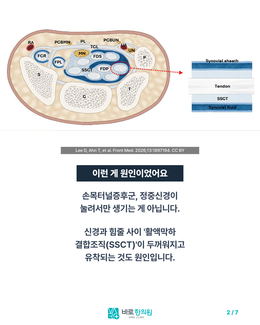 카드뉴스 슬라이드 2