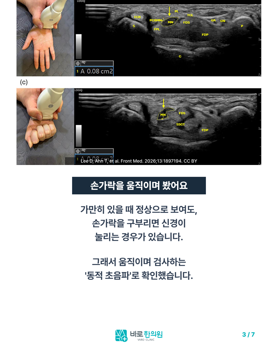 카드뉴스 슬라이드 3