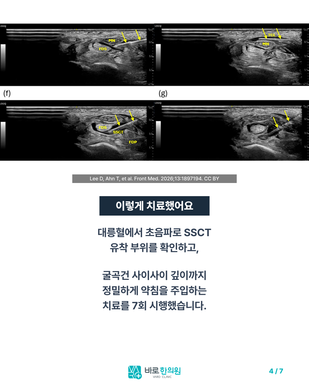 카드뉴스 슬라이드 4