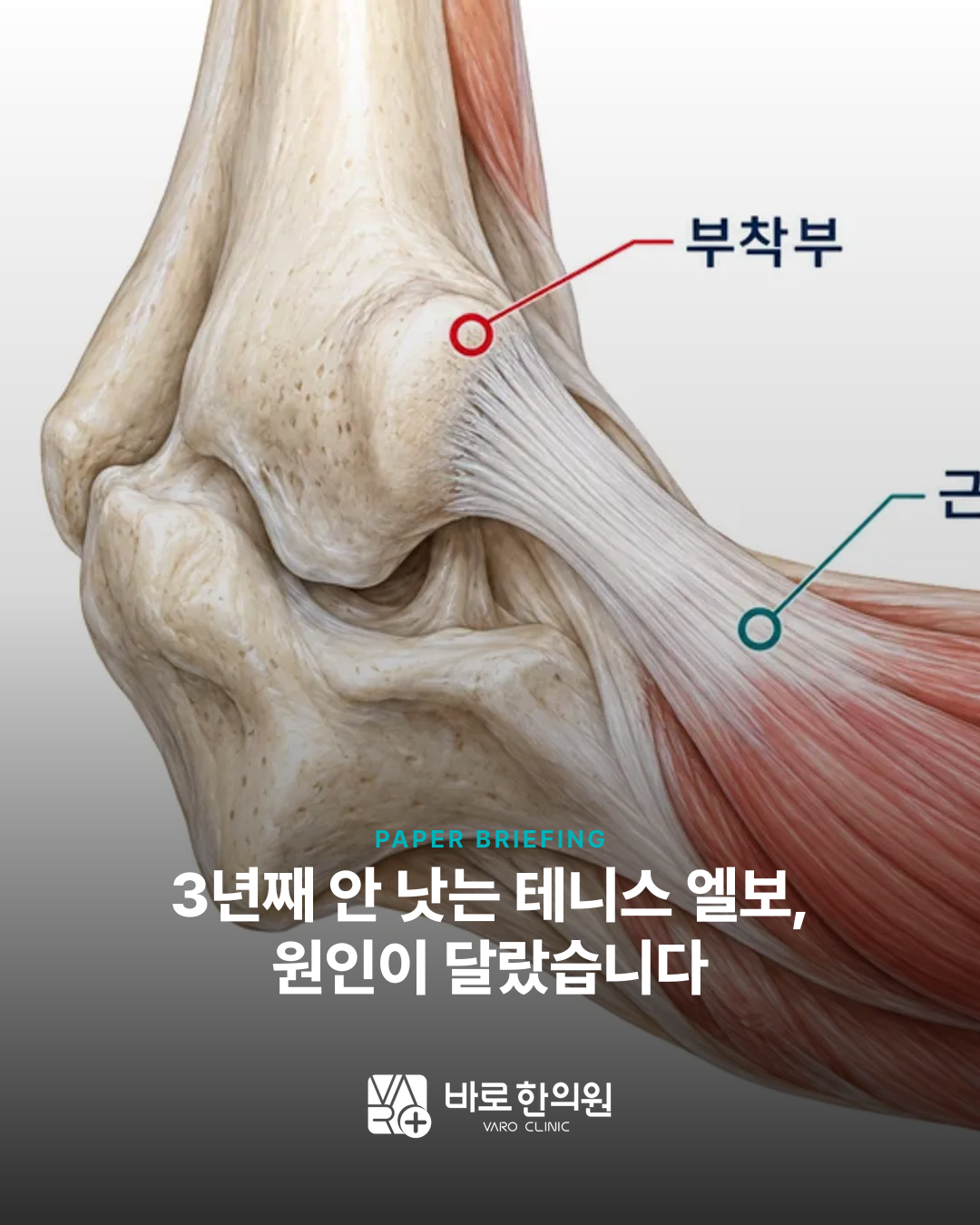카드뉴스 슬라이드 1
