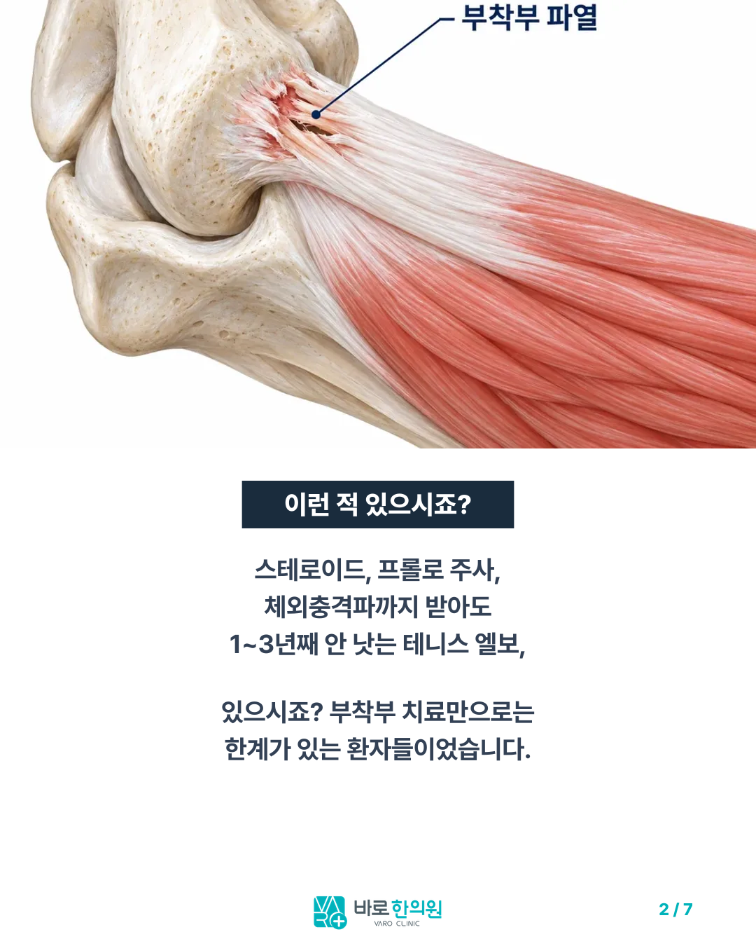 카드뉴스 슬라이드 2