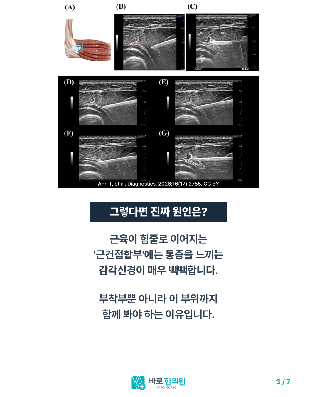 카드뉴스 슬라이드 3