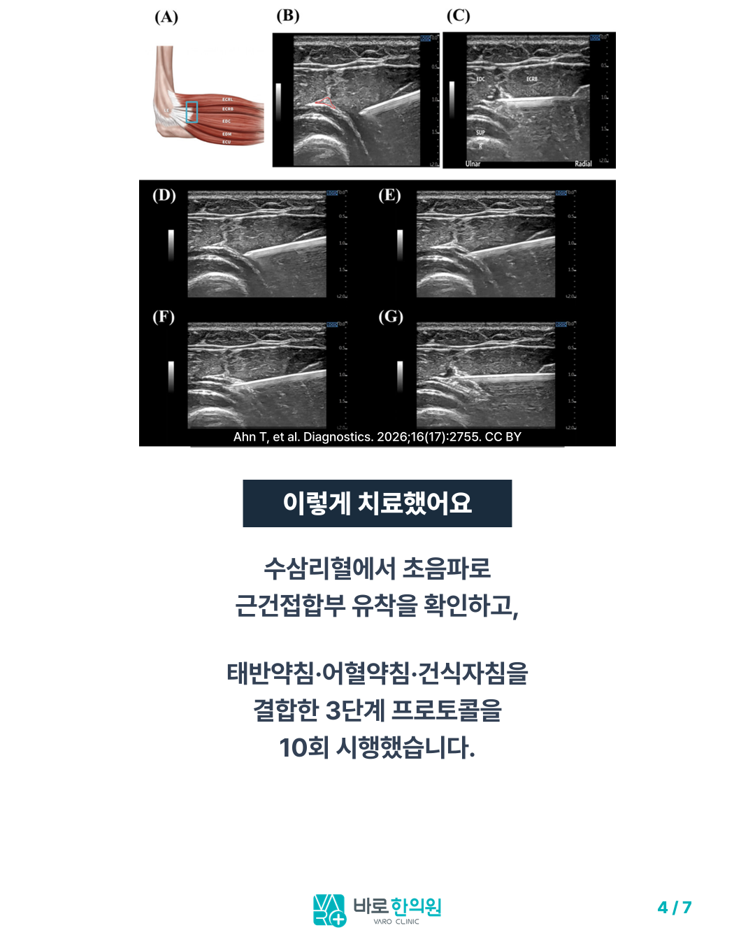 카드뉴스 슬라이드 4