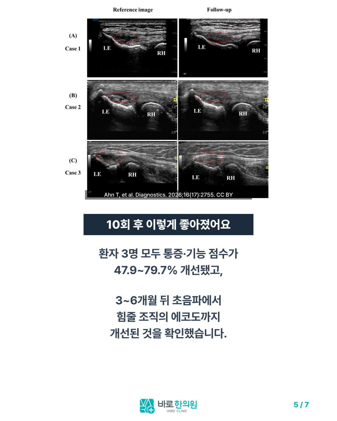 카드뉴스 슬라이드 5